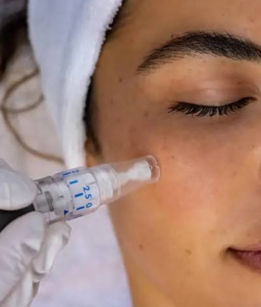 microneedling