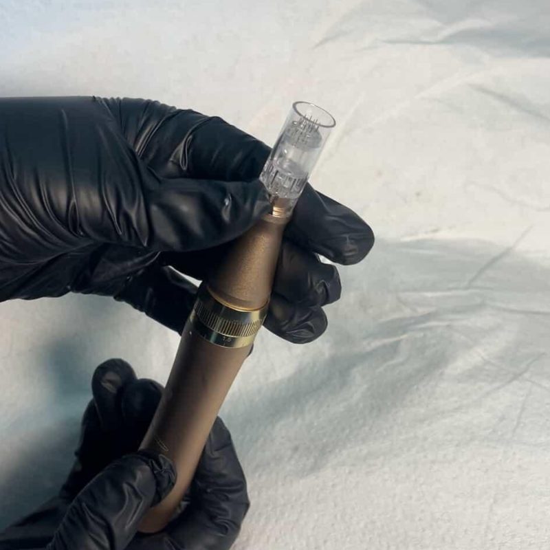 Microneedling services in nairobi